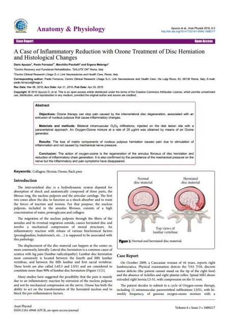 Anatomy & Physiology – A Case of Inflammatory Reduction with Ozone Treatment of Disc Herniation and Histological Changes